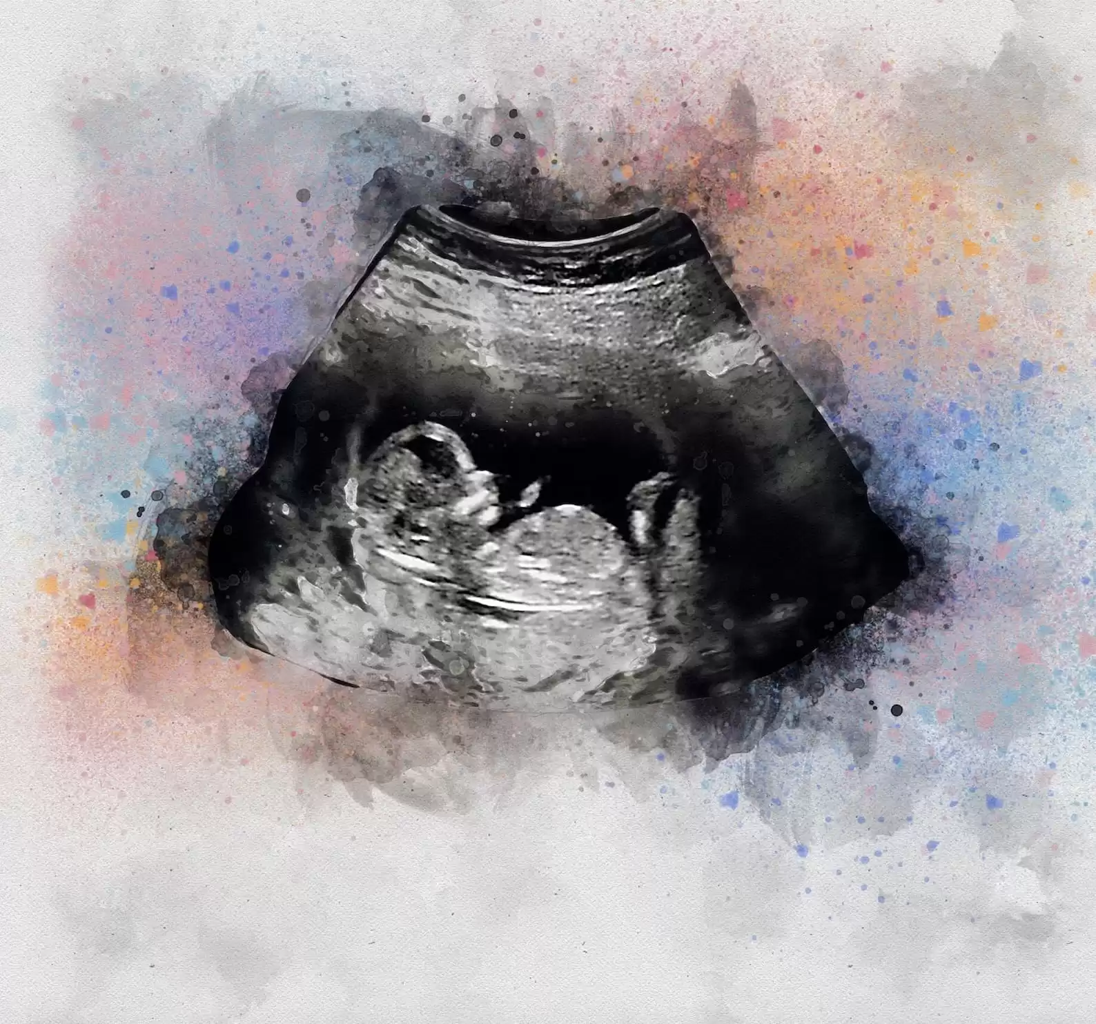 Baby Ultrasound Art Watercolor Print